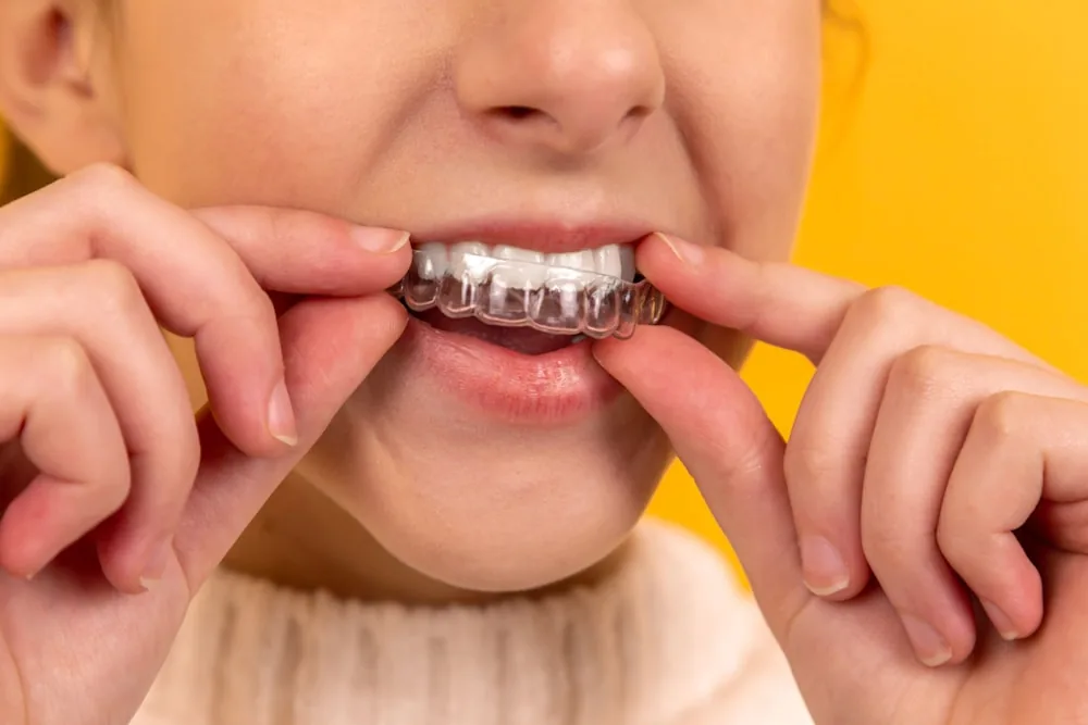 Healthy smile after dental treatment